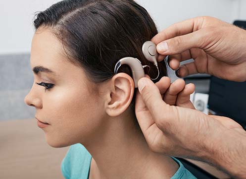 Bone Anchored Hearing Aids
